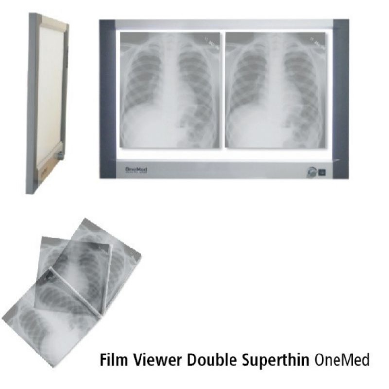 xray viewer double Onemed