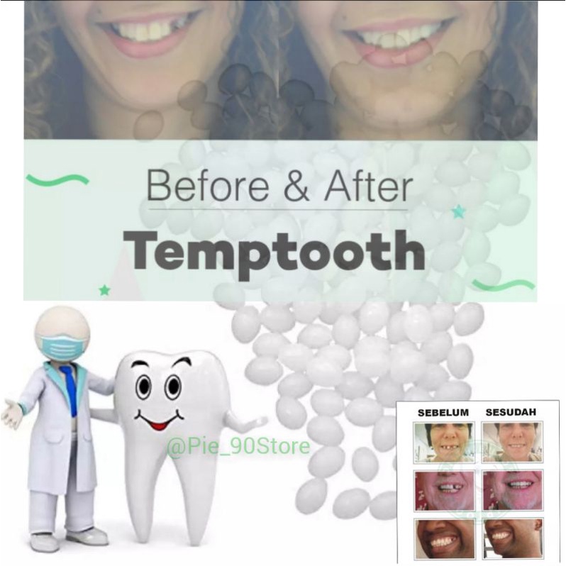 Ready!!!!Temptooth gigi palsu buat sendiri.