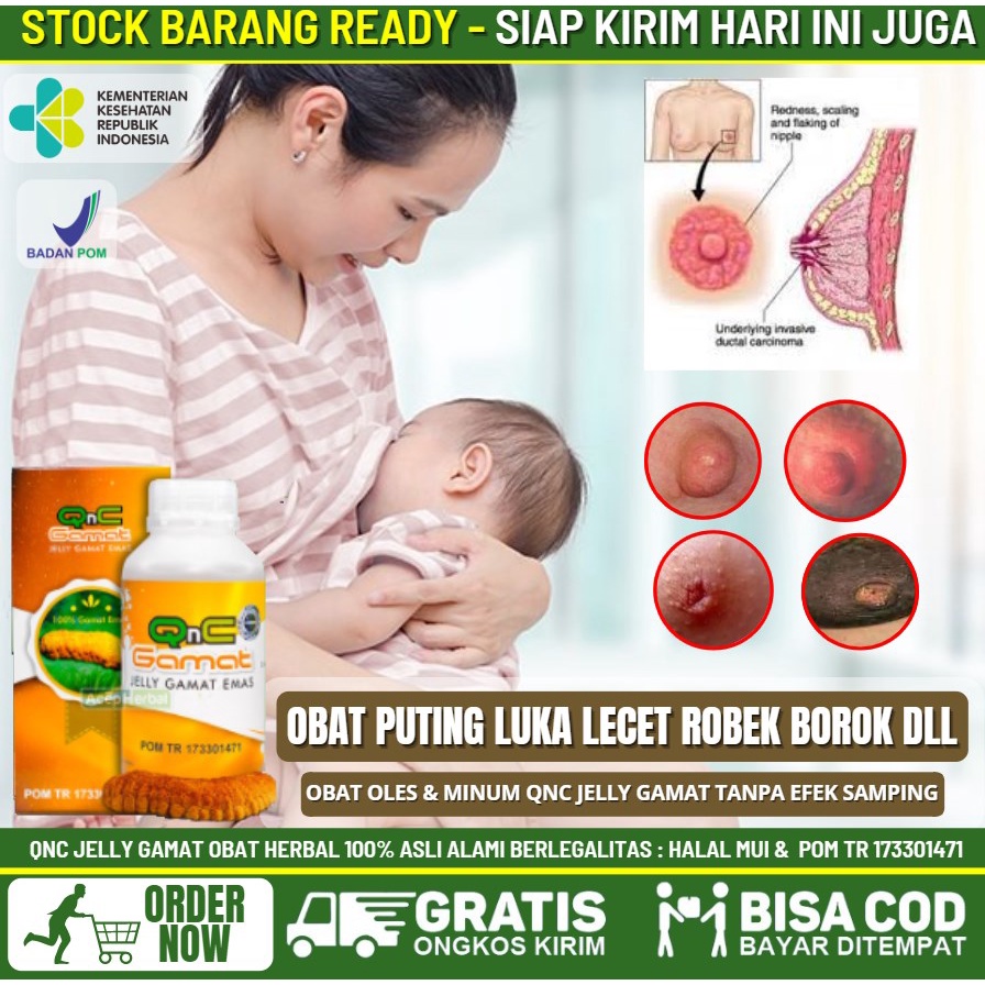 Obat Oles Puting Susu Lecet & Perih Herbal 100% Alami & Aman Jika Tertelan, Salep Puting Susu Luka A