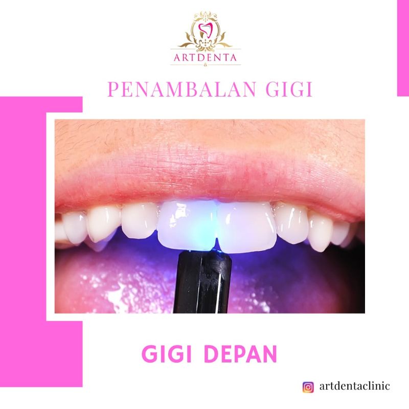 PENAMBALAN GIGI DEPAN