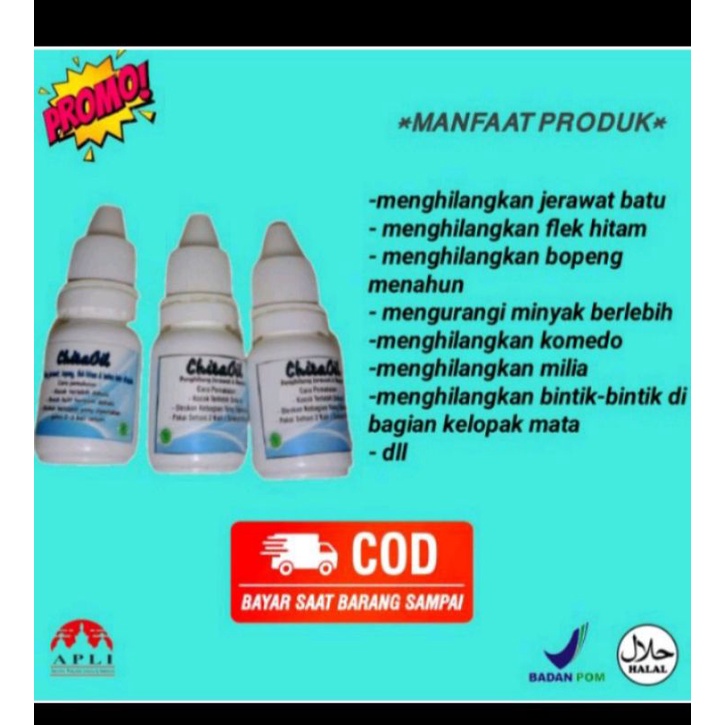 [VIRAL]CHITA OIL [PENGHILANG JERAWAT BATU,FLEK HITAM,BOPENG,KOMEDO DAN BRUNTUSAN