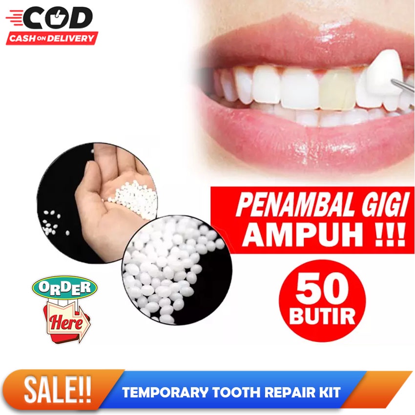GIGI PALSU SEMENTARA PENAMBAL GIGI PATAH RENGGANG TEMPORARY TOOTH TEMPTOOTH GINGSUL PATAH KELINCI