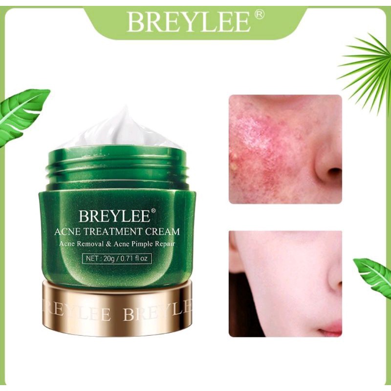 BREYLEE ACNE TREATMENT CREAM 20gr