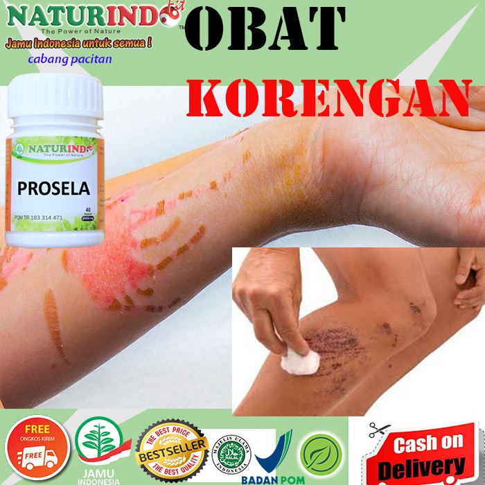 OBAT KORENG KULIT MENGHITAM PENGHILANG BEKAS LUKA KORENGAN GATAL BOPENG PALING AMPUH NATURINDO COD