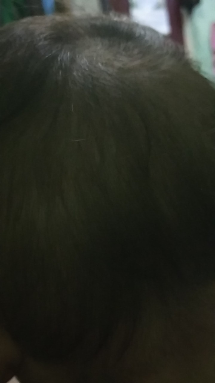 Panci Wajan Teko Masak Penggorengan Mie Elektrik Elektric Listrik Serbaguna Multifungsi  Portable