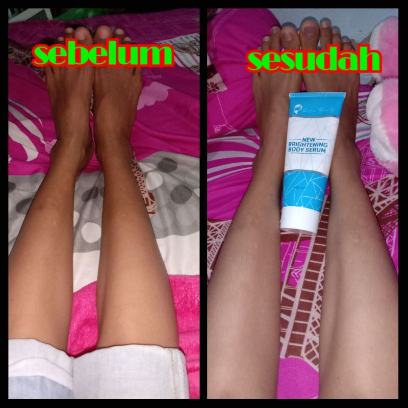 Promo New Body Serum Kedas Beauty, Pemutih badan-6