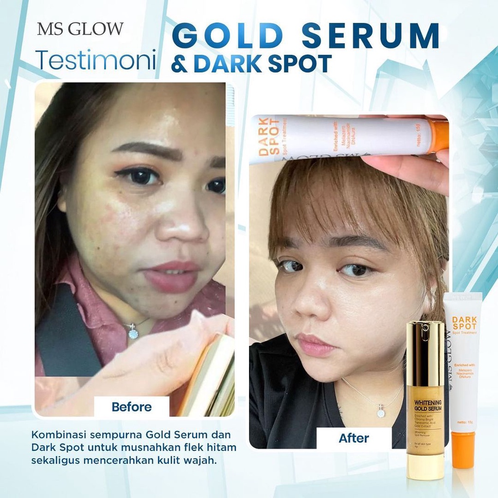 MS Glow - Paket Flek - Gold Serum & Dark Spot