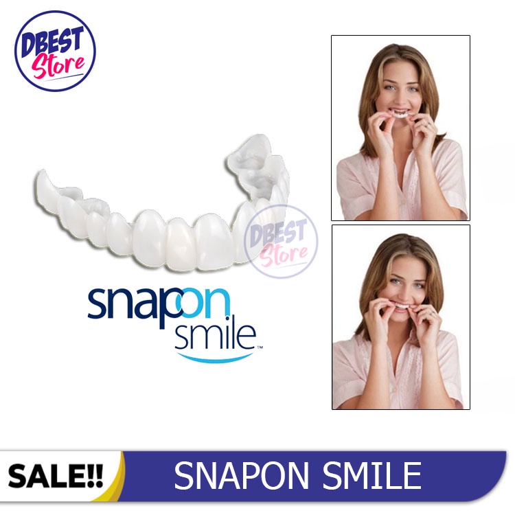 [ BAYAR TEMPAT ] ORIGINAL 100% SNAP ON SMILE SEPASANG GIGI PALSU ATAS BAWAH LEPAS PASANG