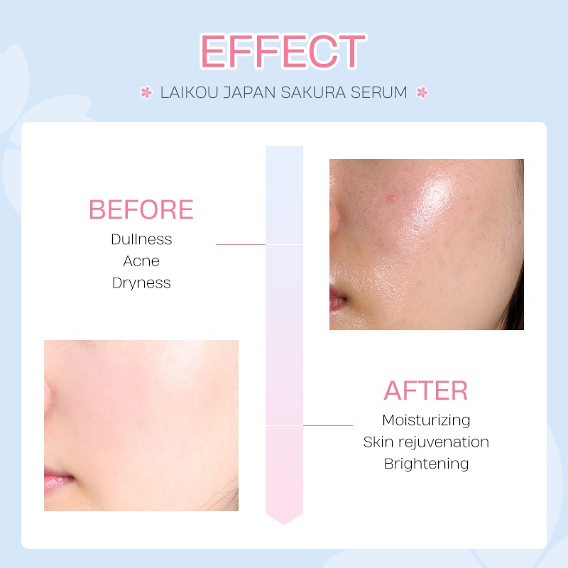 LAIKOU Sakura Serum Pemutih Wajah Menghaluskan Kerut Esensi Bunga Sakura 1ml