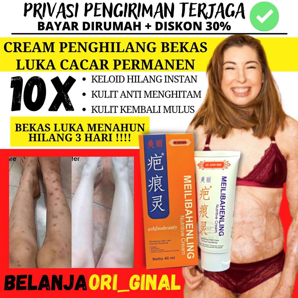Official Original Meilibahenling Penghilang Bekas Luka HItam Bopeng Koreng /Jerawat Permanen