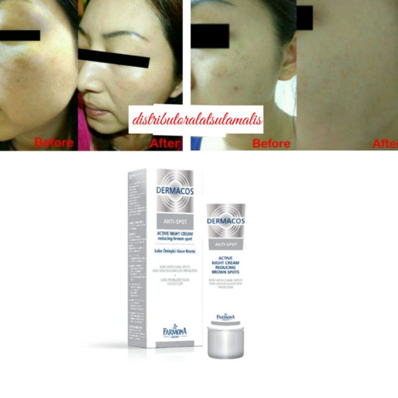 DERMACOS Active Night Cream Reducing Brown Spot