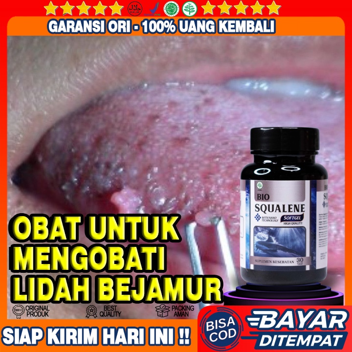Obat Lidah Berjamur - Obat Lidah Bernanah - Obat Lidah Iritasi - Obat Lidah Lecet - Obat Lidah Kebas