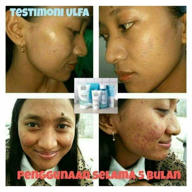 review pure skin 2 in 1 face wash and scrub