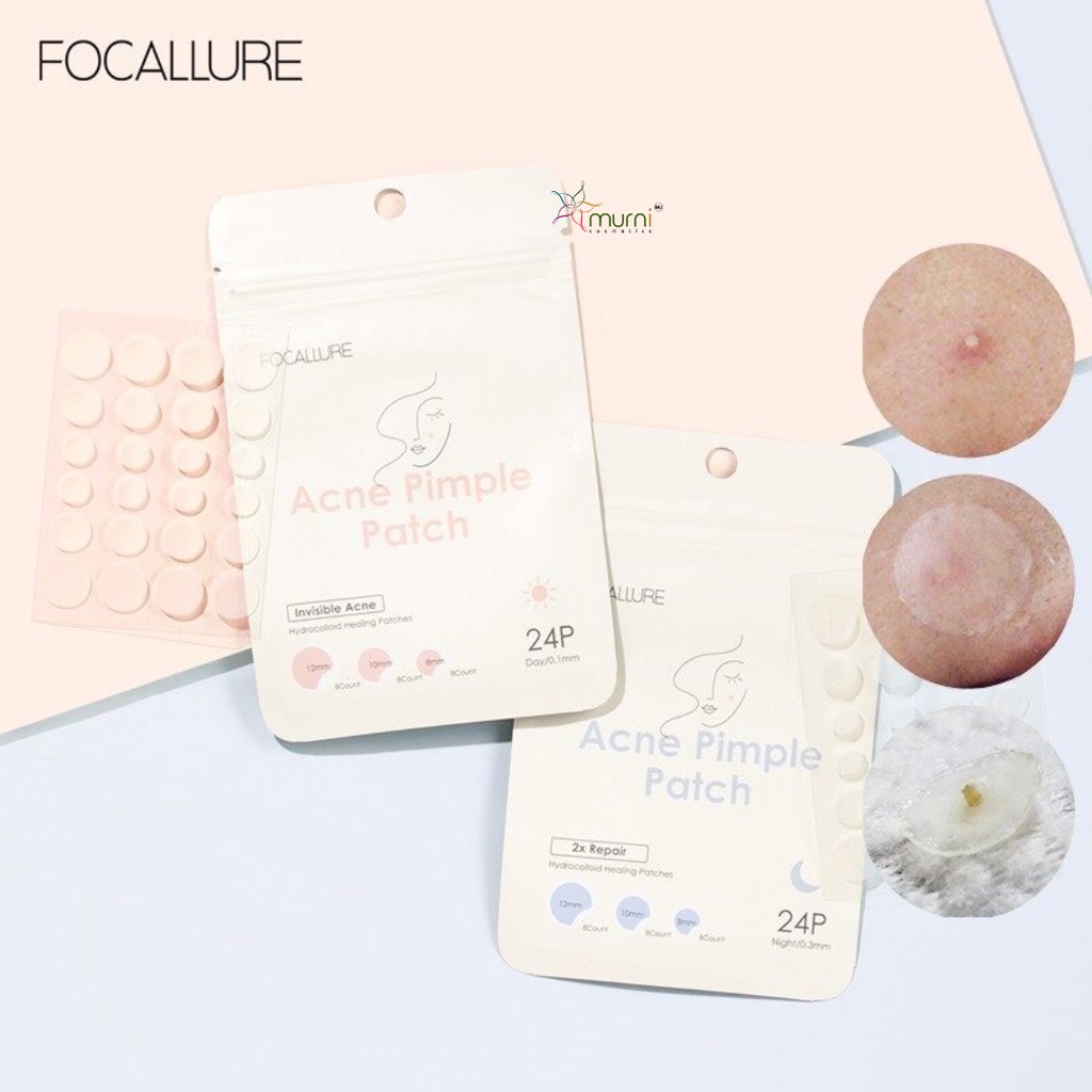 FOCALLURE ACNE PIMPLE PATCH 24P (FA186)