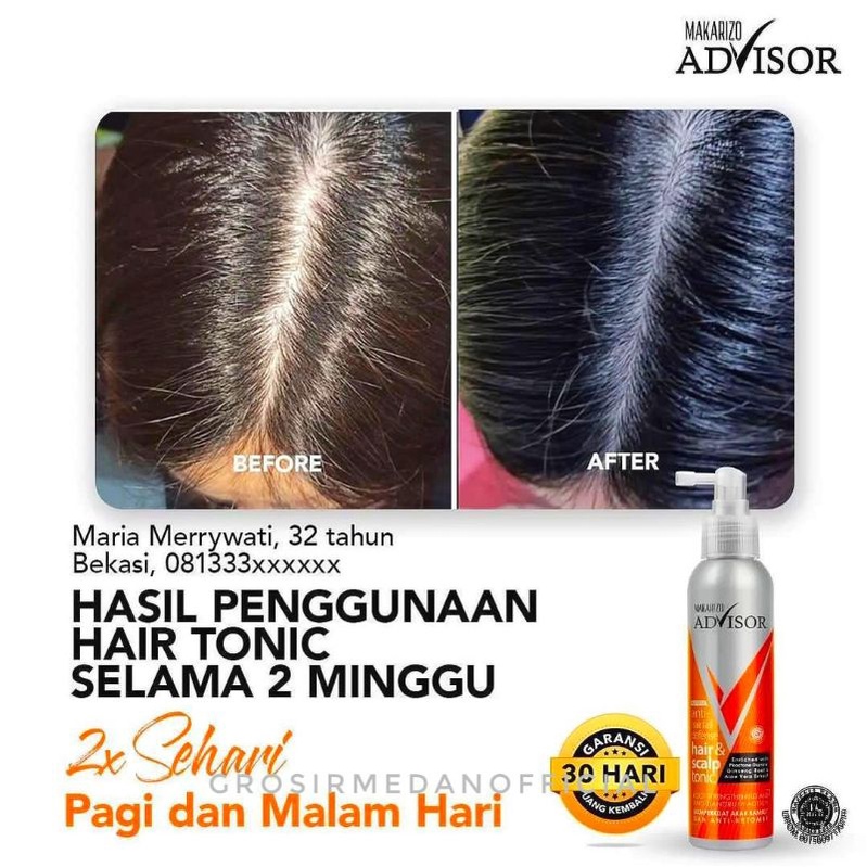 MAKARIZO ANTI HAIR FALL DEFENSE - TONIK ANTI RAMBUT RONTOK DAN KETOMBE - MAKARIZO ADVISOR HAIR AND SCALP TONIC