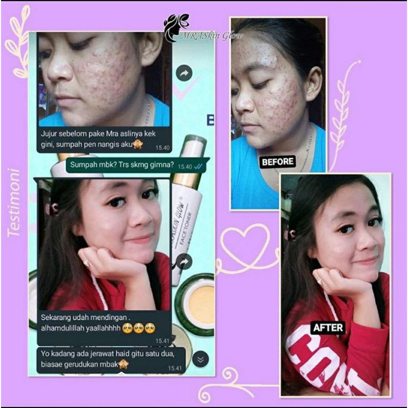 MRASKIN GLOW PAKET SKINCARE WAJAH BPOM ORIGINAL