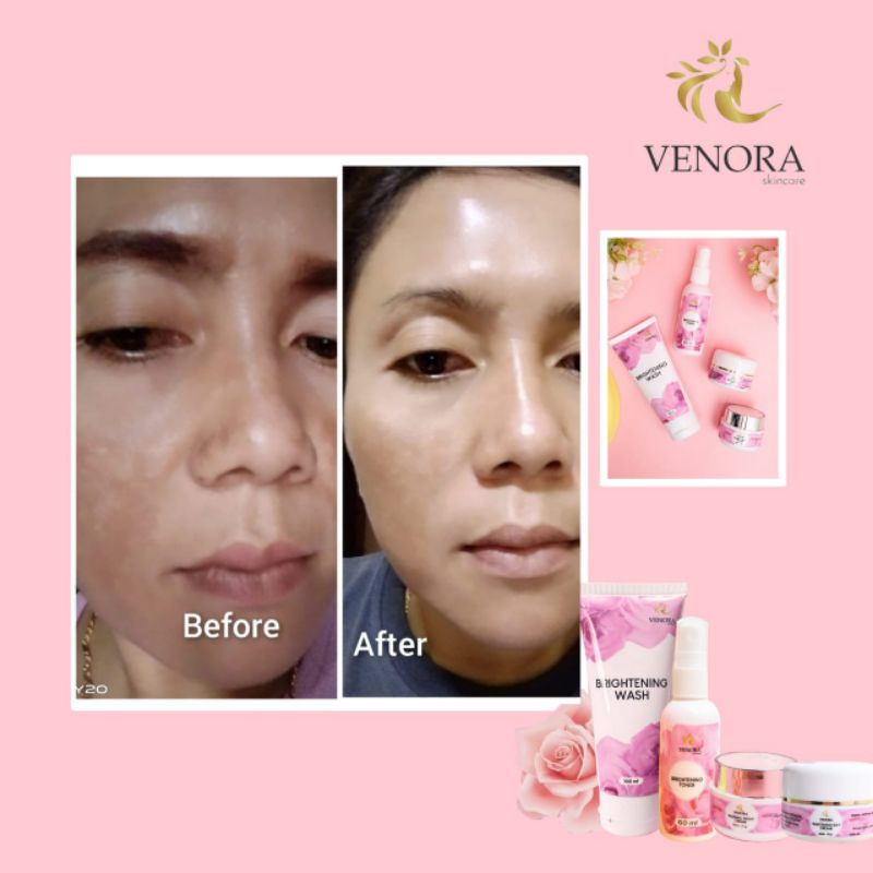 [READY ECER] NORMAL NIGHT CREAM VENORA SKINCARE CREAM MALAM VENORA