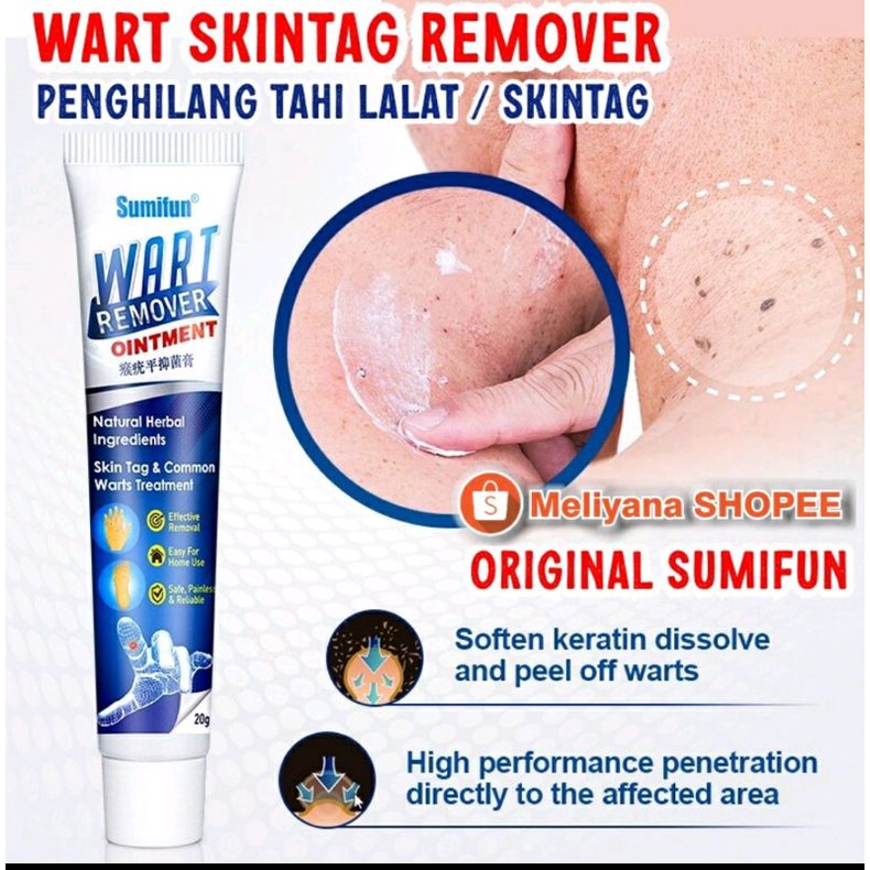 WART SUMIFUN / EELHOE WART REMOVER OBAT KUTIL OBAT TAHI LALAT MATA IKAN