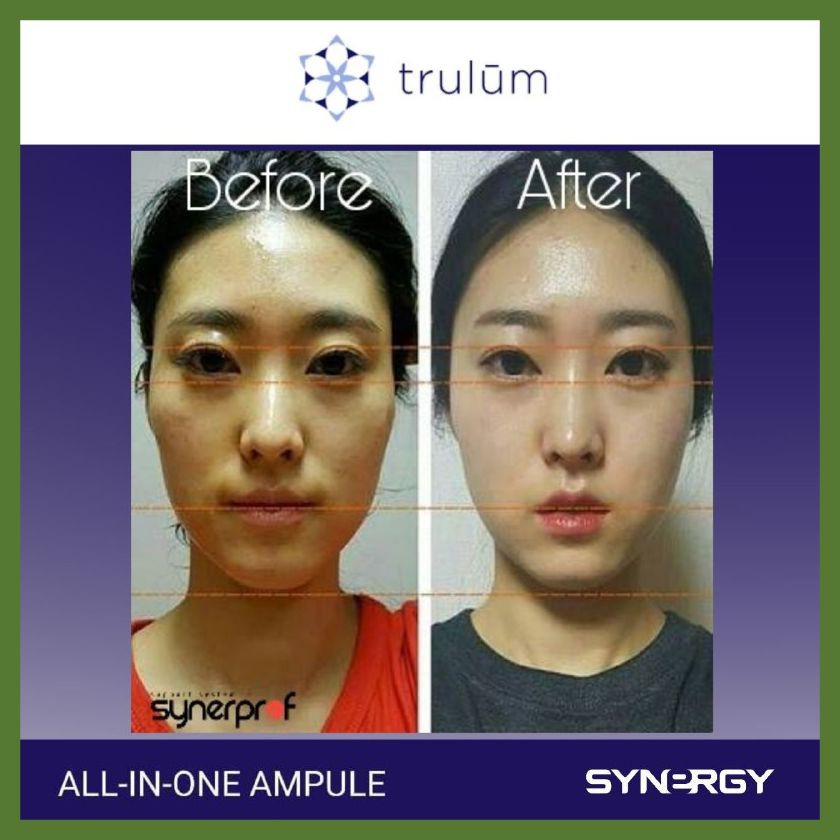 Krim Wajah Pria Wanita Penghilang Keriput Wajah & Jerawat Paling Ampuh