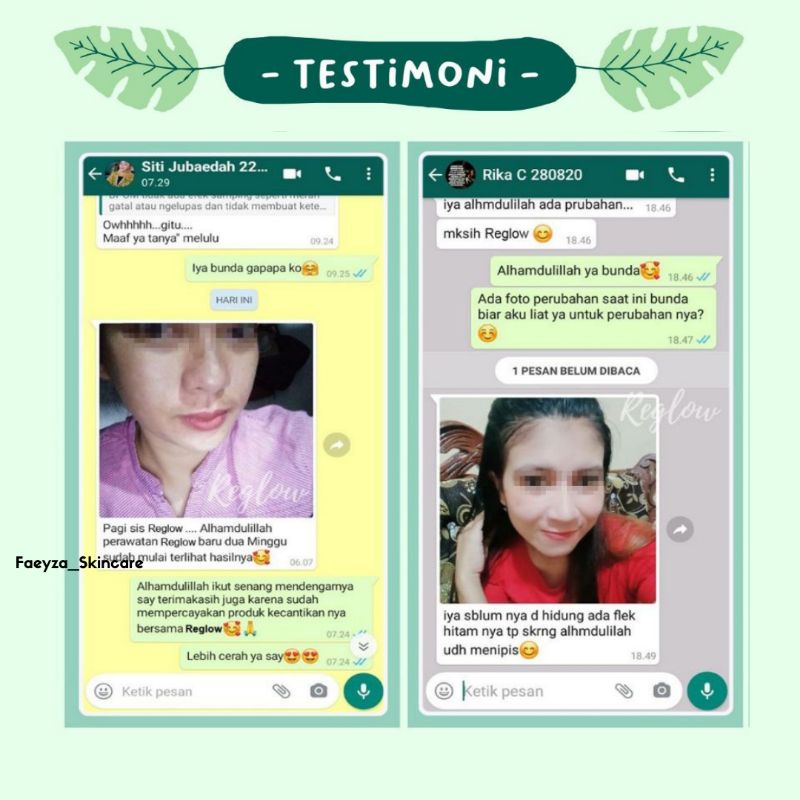 Paket Cream Skincare Kit Acne Pemutih Pria Wanita BPOM Reglow Glowing Skincare Routine | Tas nindhy Moonzaya