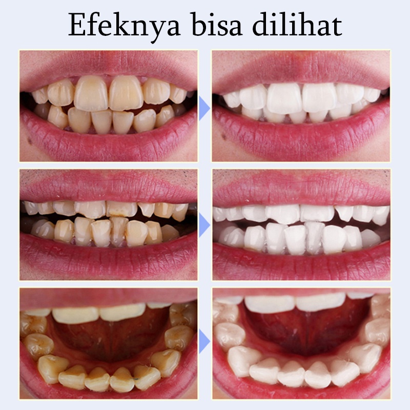 Bedak Pemutih Pembersih Gigi kuning Teeth whitening Pemutih gigi dan penghilang karang gigi 50g  Mencegah Kerusakan Gigi Menghilangkan Karang Gigi
