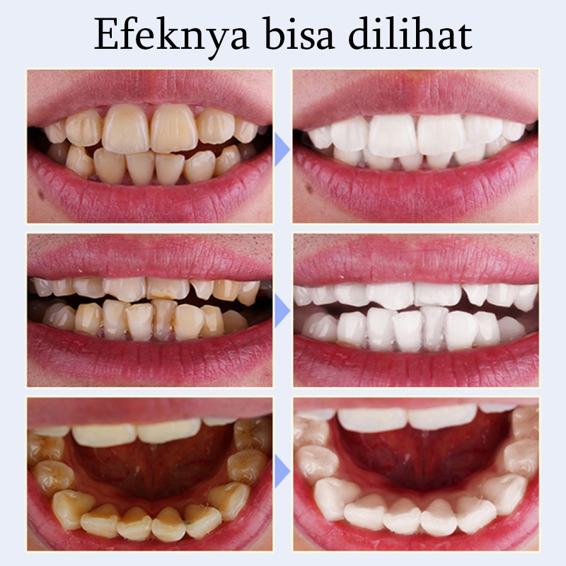 Bedak Pemutih Pembersih Gigi kuning Teeth whitening Pemutih gigi dan penghilang karang gigi 50g  Mencegah Kerusakan Gigi Menghilangkan Karang Gigi