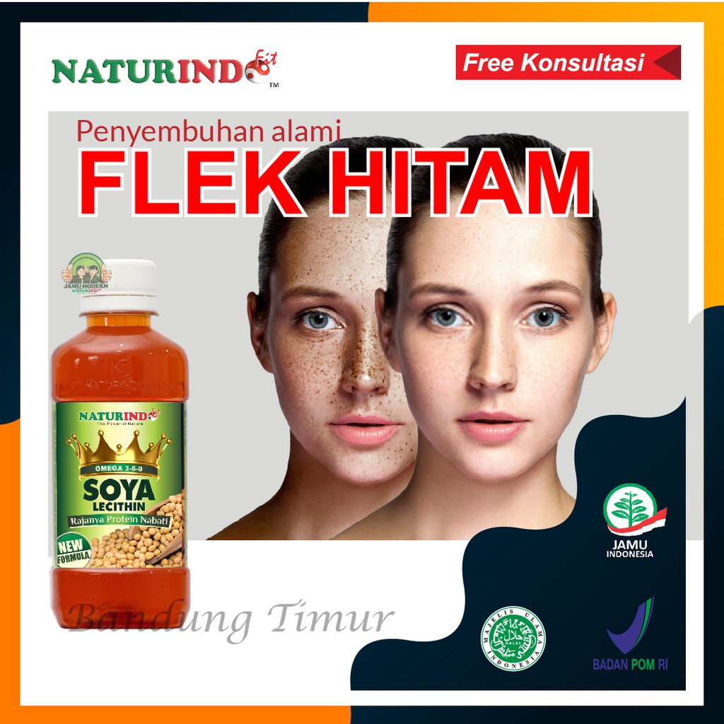 Jual Penghilang Flek Hitam Di Wajah Obat Flek Hitam Herbal Alami Ampuh