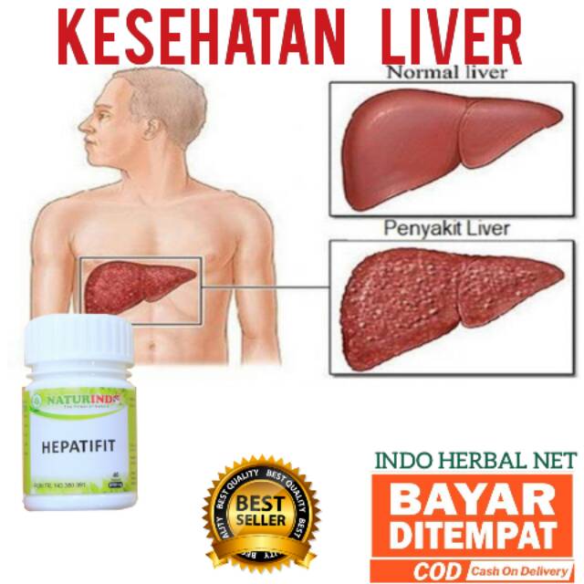 OBAT HEPATIFIT SPESIAL SAKIT LIVER - SAKIT HATI - HEPATITIS - OBAT LIVER - OBAT PENYAKIT LIVER