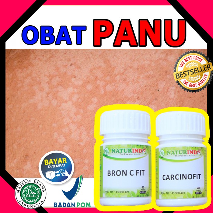 

OBAT PANU MENAHUN JAMUR KULIT KADAS KURAP PALING AMPUH TERUKTI HERBAL ALAMI NATURINDO COD