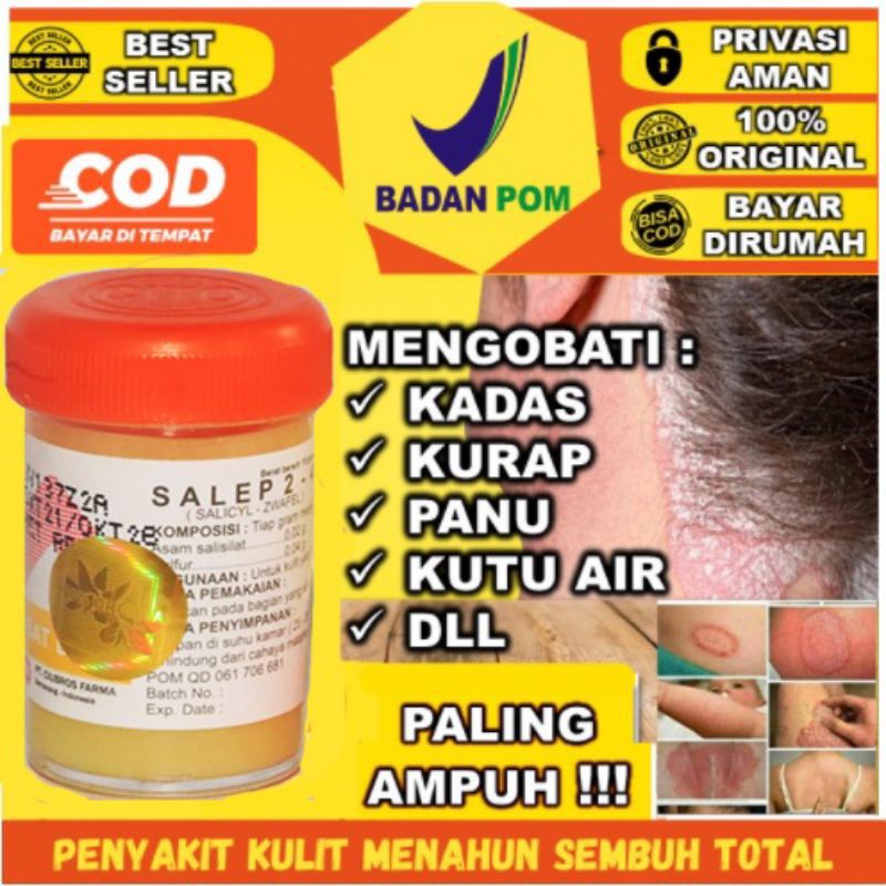 Salep Gatal - Gatal 24 Original BPOM Salep Gatal kutu air dll