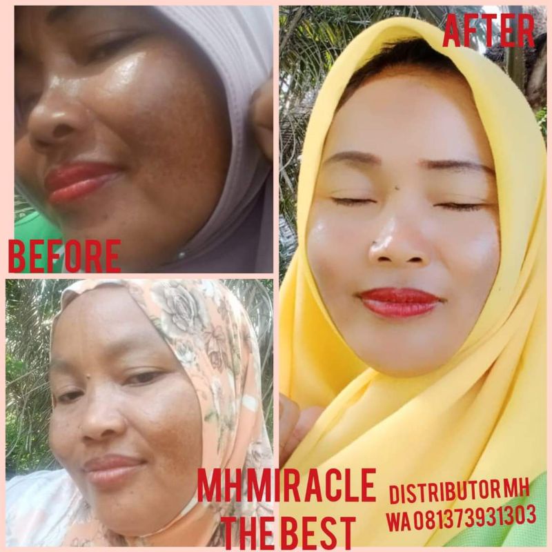 (FREE ONGKIR/COD)PAKET MURAH HEMAT MH MIRACLE ORI 100% BONUS KAPAS KECANTIKAN
