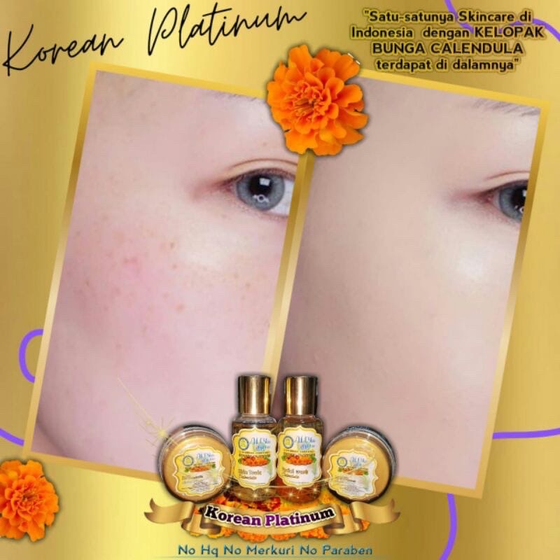 KOREAN PLATINUM ALESKIN GLOW Skincare Glowing-Paket Perawatan Wajah Korea-Cream Glowing-Cream Pemutih Wajah