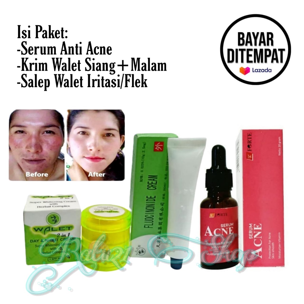 Paket 3in1 Skincare Walet Herbal/Krim Wajah Siang Malam+Salep Perawatan Flek Hitam Dan Penghilang Je