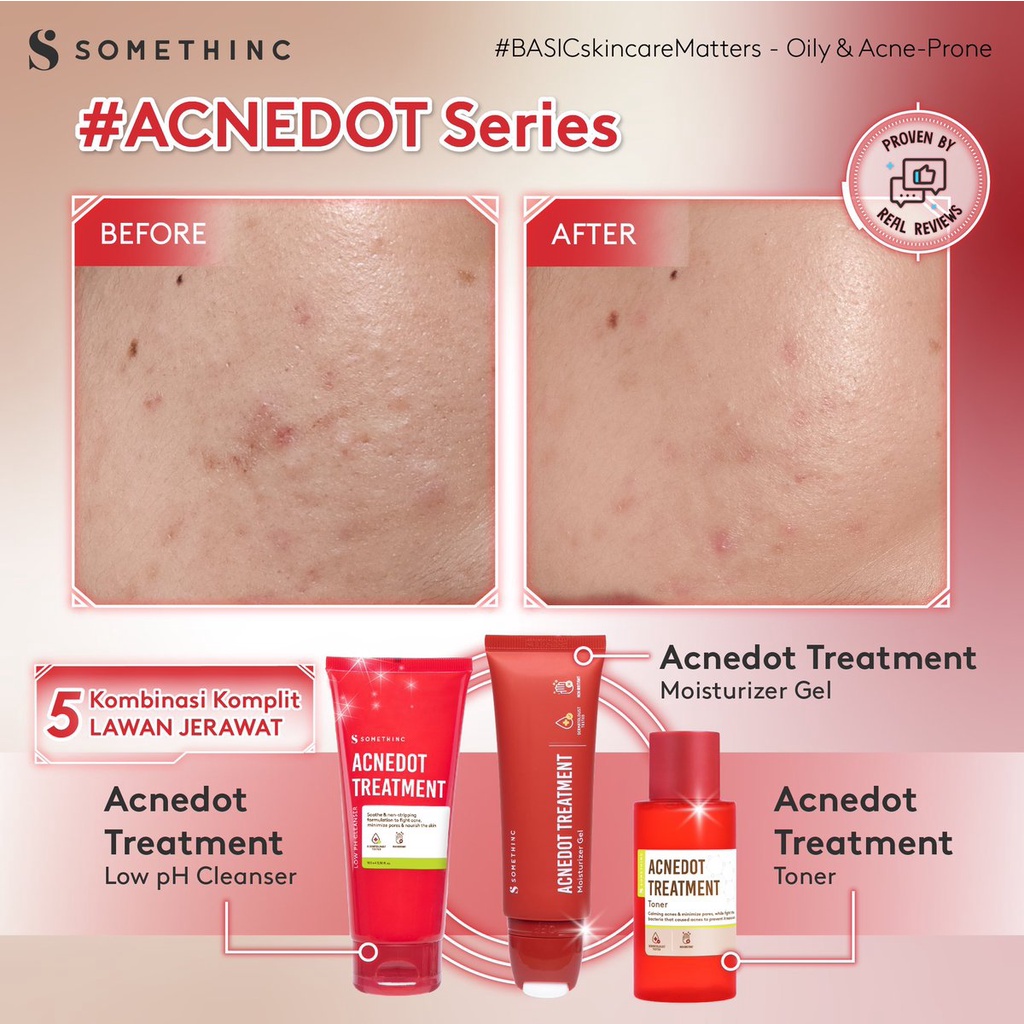 SOMETHINC ACNEDOT Treatment Moisturizer Gel