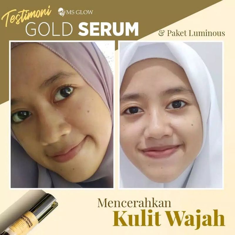 SERUM MS GLOW ORIGINAL (SUDAH BER BARCODE) / SERUM WHITE CELL DNA / SERUM WHITENING GOLD / SERUM ACNE / SERUM LUMINOUS SERUM LIFTING PEELING