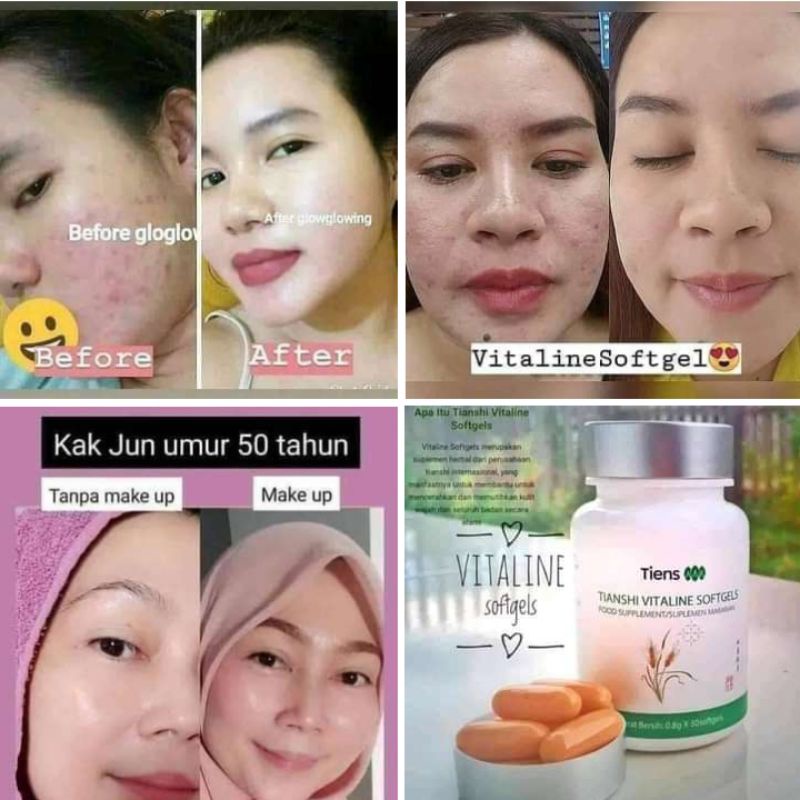 vitaline softgels