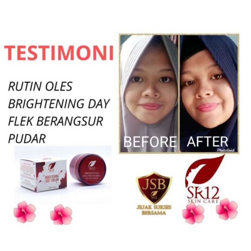 BRIGHTENING CREAM SERIES SR12 SKINCARE GLOWING BERSIH CERAH -KRIM PENCERAH/ KRIM PENGHILANG FLEK/ DAILY CREAM/ KRIM SIANG MALAM/ BRIGHTENING CREAM SR12 BPOM/ PERAWATAN UNTUK KULIT NORMAL