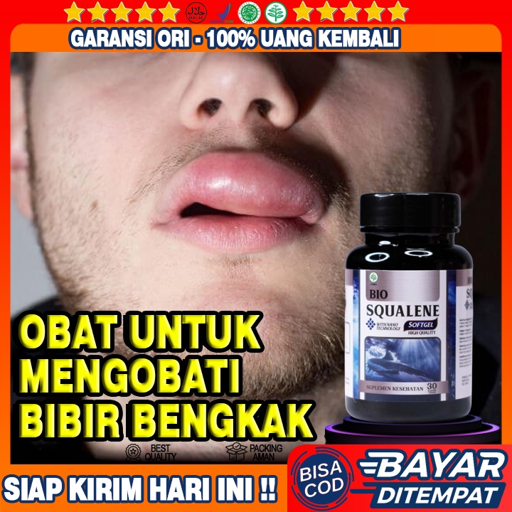 Obat Bibir Bengkak, Obat Bibir Pecah Pecah,  Obat Bibir Kering Terasa Perih, Beradarah, Benjolan Di 
