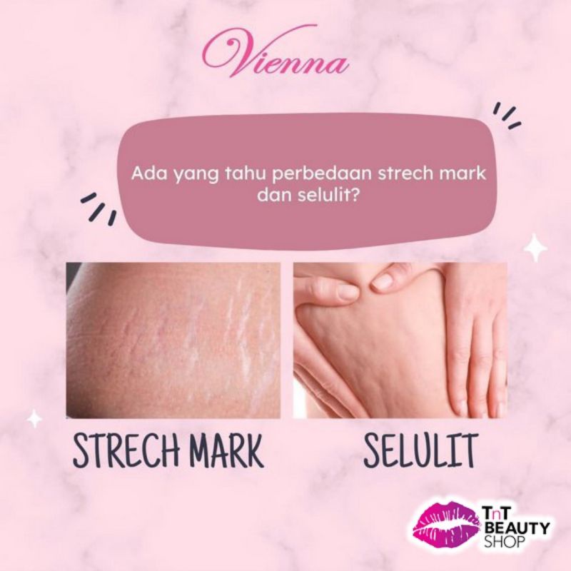 [rumahbayipdg] Vienna cream ORIGINAL penghilang Stretch Mark/Garis perut /selulit