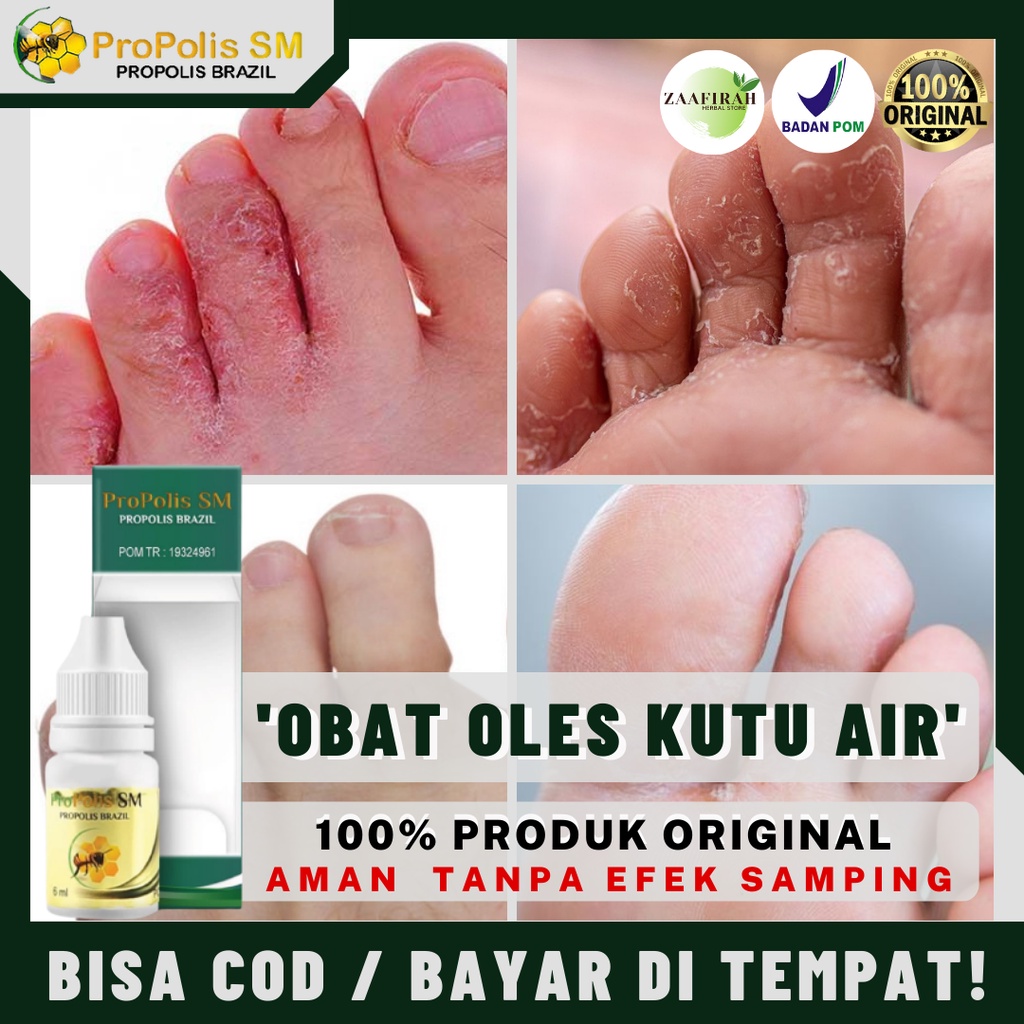 Bintik Air Di Jari Kaki