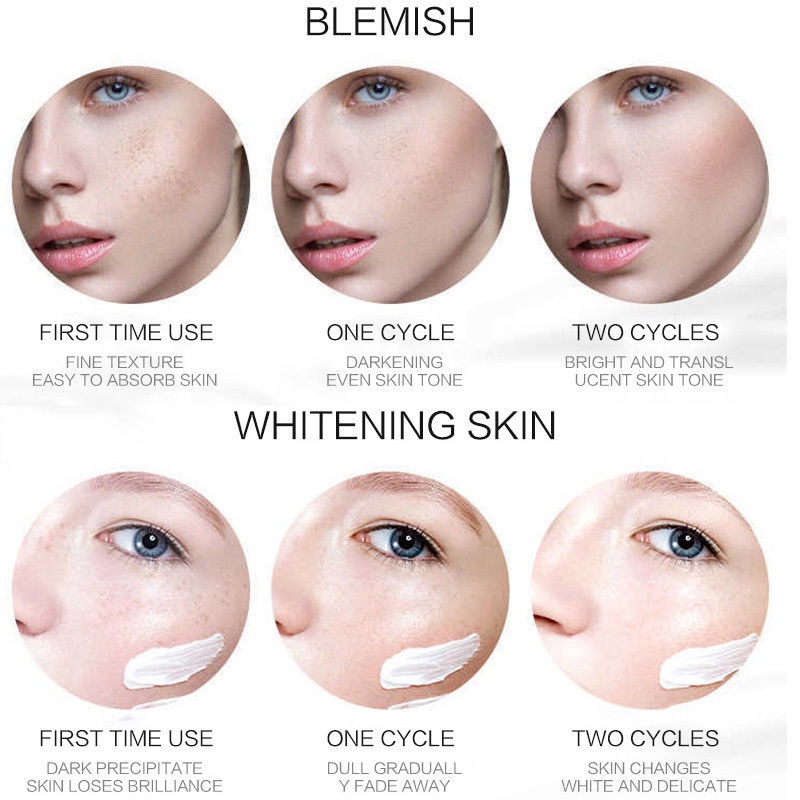 【Barang spot】Krim pemutih krim bintik penghilang flek hitam Salep Flek Hitam Melasma Ampuh Remedy Black Spots Remedy 30g Penghapusan Bintik Hitam Penghapusan Bekas Jerawat yang Efektif Dapat digunakan saat menyusui