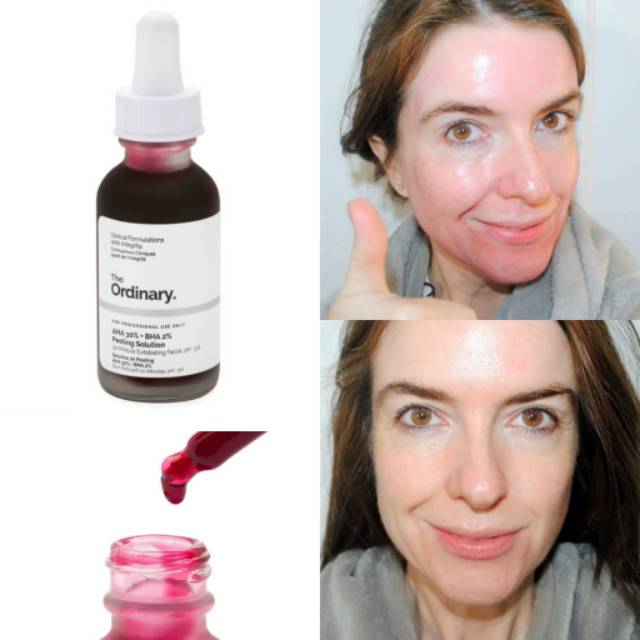 The Ordinary Aha 30 Bha 2 Peeling Solution Shopee Indonesia