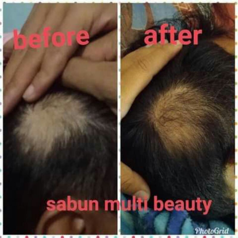 Sabun Multi beauty ( MBS )