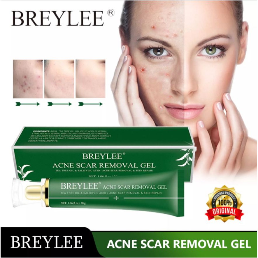 Acne Scar Removal Gel Penghilang Bekas Luka Jerawat Bintik-Bintik Pigmentasi Perawatan Kulit