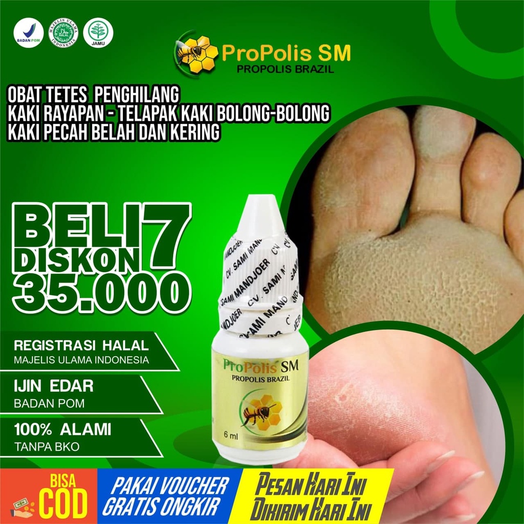 Obat Kaki Rayapan Kaki Rayapan Bau Telapak Kaki Bolong-Bolong Kecil Berlubang Kaki Rorombeheun - Oba