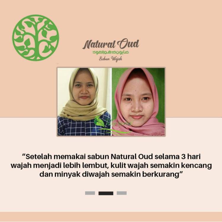 Sabun Natural Oud - Obat Penghilang Jerawat, Milia, Noda Flek Hitam, Mengencangkan Kulit Muka, Penghilang Pori-Pori Besar, Bopeng, Bekas Flek Jerawat, Sabun Wajah Cuci Muka Kecantikan Alami 100% Original