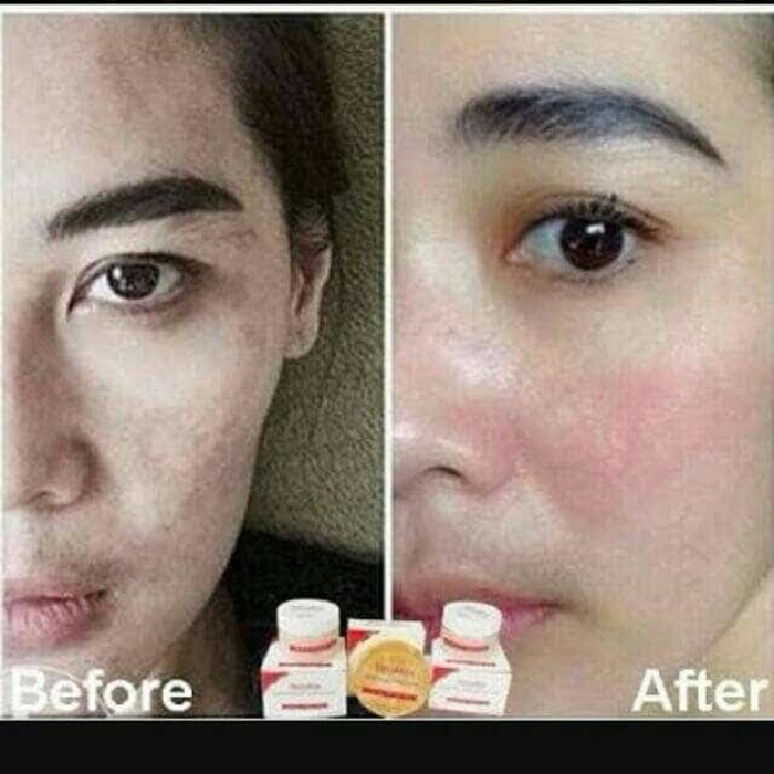 Krim Lengkap Krim Siang - Krim Malam - Sabun Collagen - Liyoskin Creram Wajah 100% Halal BPOM