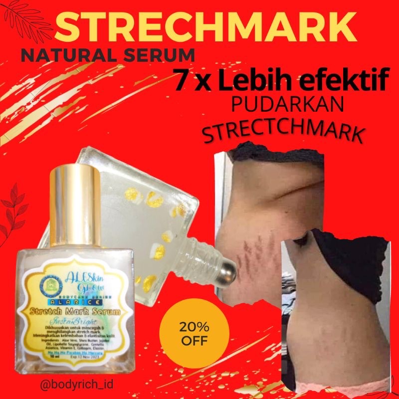 ALARICE STRECHMARK CREAM PENGHILANG STRETCH MARK PALING AMPUH PERMANEN UNTUK IBU HAMIL 1