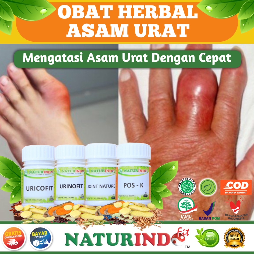 OBAT ASAM URAT OBAT HERBAL JAMU ASAM URAT AMPUH HERBAL ASAM URAT ALAMI URICOFIT NATURINDO