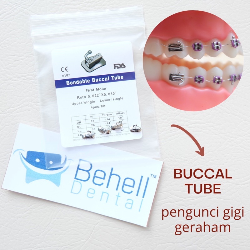 BUCCAL TUBE PENGUNCI BEHEL BRACKET KAWAT GIGI GERAHAM M1 M2 ROTH BUCAL - DENTAL ORTHO ORIGINAL